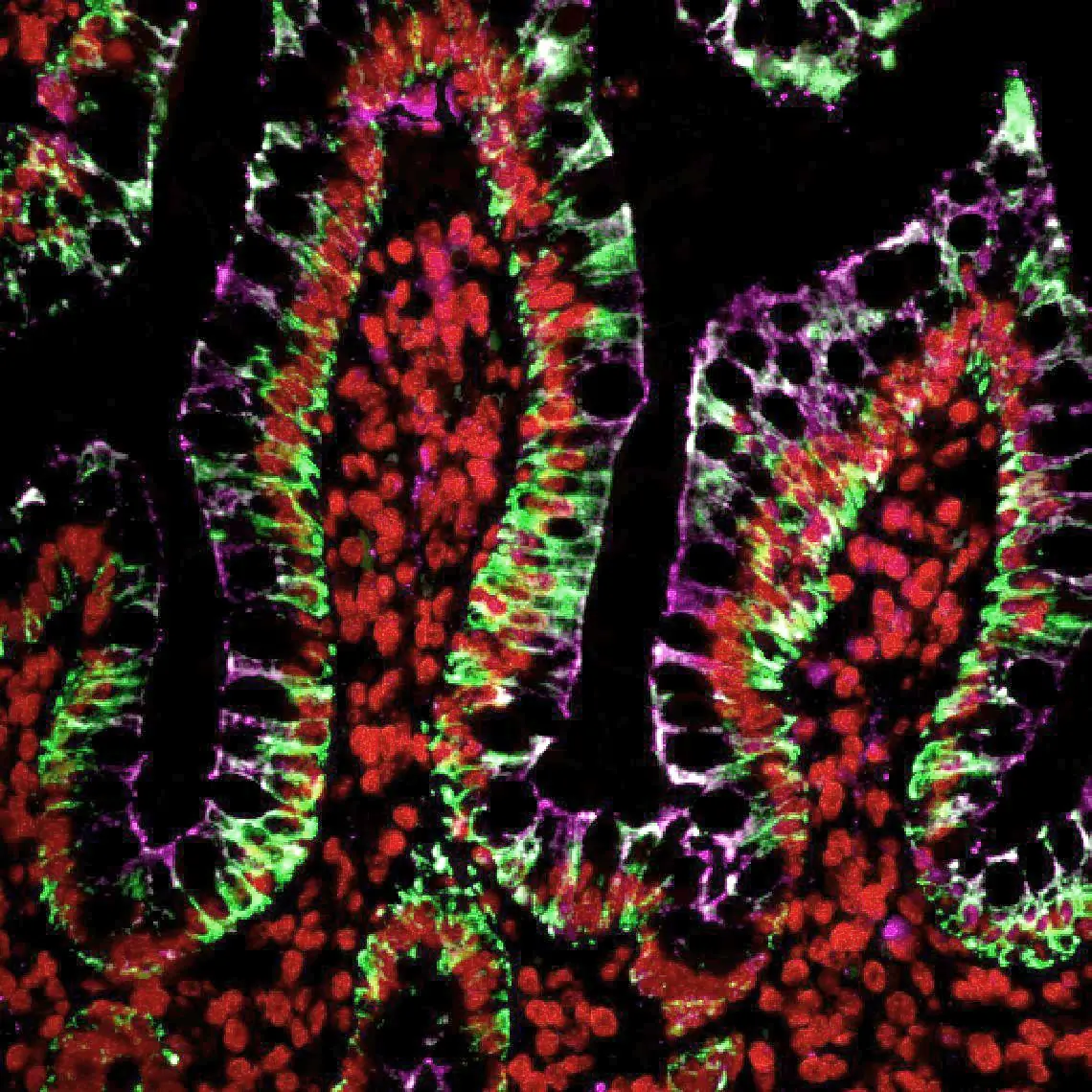 Sequential multiplex tyramide labeling of human colon FFPE section with three CF® Dye Tyramides. Cytokeratin (pan) was labeled with CF®488A Tyramide (green); Histone H1 was labeled with Cyanine 555 Tyramide (red); ZO1 was labeled with CF®640R Tyramide (magenta).