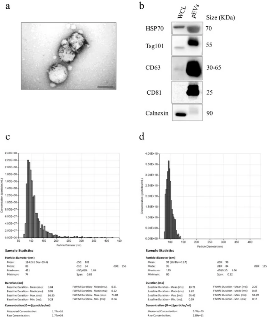 Characterization of pEVs in Melanoma Patients and Healthy Controls using Izon Exoid TRPS.