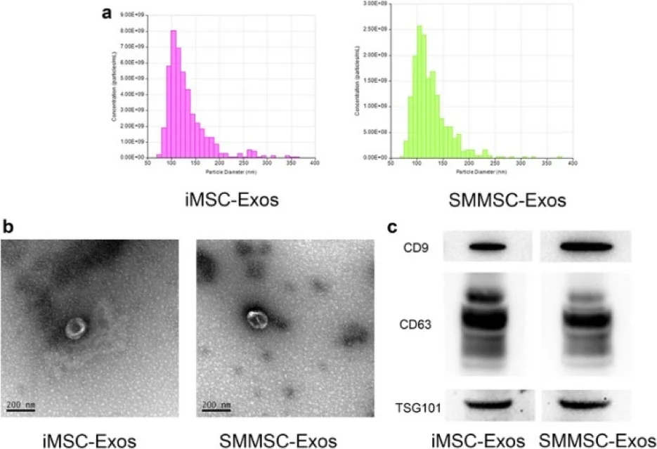 TRPS measurement showing exosome concentration and size distribution.