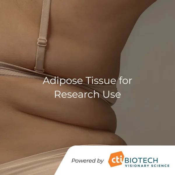 Human Adipose Tissue for research