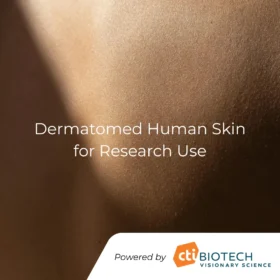 Dermatomed Human Skin for Research Use