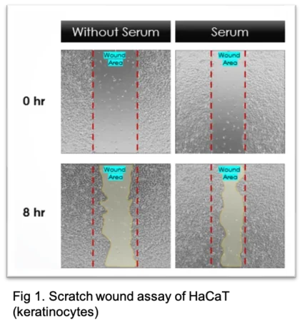 A linear scratch wound were created on a confluent layer of seeded cells and were treated in DMEM low glucose in the absence or presence of 10% FBS for 8 hours. Images were captured at regular intervals to analyse the wound closure over time.