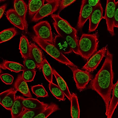 Staining of cells on Transwell® cell culture insert with NucSpot® 500/515 (green) and CytoLiner™ 570/590 (red). HeLa cells were grown on a 6-well Transwell® insert. The insert with cells was fixed in the microplate with 4% PFA, then permeabilized for 10 minutes at room temperature with PBS/0.1% Triton X-100 and washed with PBS. The insert was stained with 1X NucSpot® and 1X CytoLiner™ in 1X CytoLiner™ Staining Buffer for 10 minutes at room temperature and washed with PBS. The insert was cut from the support using a scalpel and mounted on a slide under a coverslip with 1% methylcellulose in PBS, then imaged by confocal microscopy.