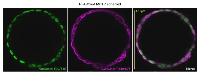 Staining of PFA-fixed MCF7 spheroid by NucSpot® 500/515 (green) and CytoLiner™ 650/675 (magenta). MCF-7 cells were grown in a cell repellent U-bottom 96-well plate for 17 days to allow spheroid formation, then fixed with 4% PFA. Cells were permeabilized for 10 minutes at room temperature with PBS/0.1% Triton® X-100 and stained with 1X NucSpot® and 1X CytoLiner™ in 1X CytoLiner™ Staining Buffer for 10 minutes at room temperature, washed, and imaged by confocal microscopy using an Evident FV4000 imaging system.