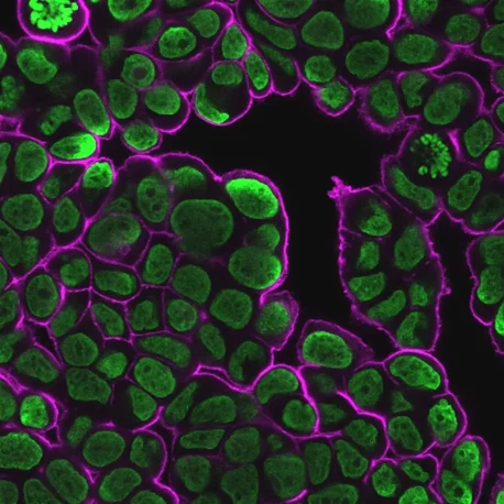 Staining of cells on Transwell® cell culture insert with NucSpot® 500/515 (green) and CytoLiner™ 650/675 (magenta). MCF7 cells were grown on a 6-well Transwell® insert. The insert with cells was fixed in the microplate with 4% PFA, then permeabilized for 10 minutes at room temperature with PBS/0.1% Triton X-100 and washed with PBS. The insert was stained with 1X NucSpot® and 1X CytoLiner™ in 1X CytoLiner™ Staining Buffer for 10 minutes at room temperature and washed with PBS. The insert was cut from the support using a scalpel and mounted on a slide under a coverslip with 1% methylcellulose in PBS, then imaged by confocal microscopy.