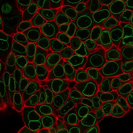 PFA-fixed MCF7 cells were permeabilized for 10 minutes at RT with 0.1% Triton® X-100 in PBS and stained with 1X CytoLiner™ 570/590 dye in 1X CytoLiner™ Staining Buffer. Cells were then blocked with PBS/2% fish gelatin and stained with 5 ug/mL CF488A Recombinant Anti-Nuclear Membrane Antibody (clone 2406.NM) in the same buffer used for blocking. CytoLiner™ staining is shown in red, nuclear membrane antibody staining is shown in green.