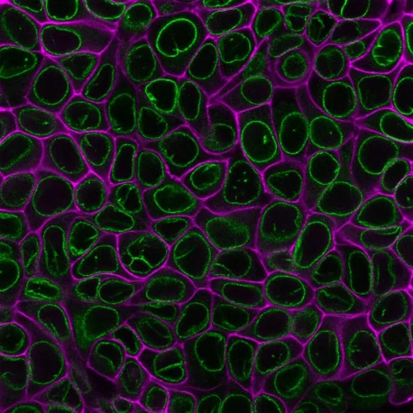 PFA-fixed MCF7 cells were permeabilized for 10 minutes at RT with 0.1% Triton® X-100 in PBS and stained with 1X CytoLiner™ 650/675 dye in 1X CytoLiner™ Staining Buffer. Cells were then blocked with PBS/2% fish gelatin and stained with 5 ug/mL CF488A Recombinant Anti-Nuclear Membrane Antibody (clone 2406.NM) in the same buffer used for blocking. CytoLiner™ staining is shown in magenta, nuclear membrane antibody staining is shown in green.