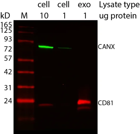Western blot showing CD81 enrichment in exosomes using ExoBrite™ Western Antibodies in MCF-7 cell and exosome lysates. Exosomes were isolated from MCF-7 cell conditioned medium by size exclusion column. The indicated amounts of lysates from MCF-7 cells and MCF-7-derived exosomes were run on an acrylamide gel and transferred to PVDF. The membrane was blocked with TrueBlack® Western Blocking Buffer, stained with 1X ExoBrite™ 680/700 CD81 Western Antibody and 1X ExoBrite™ 770/800 Calnexin Western Antibody, and imaged on a LI-COR Odyssey® infrared imaging system in the 700 and 800 channels. The protein ladder is Peacock™ Prestained Protein Marker, 1.5 uL loaded.