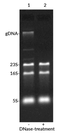 Total RNA was extracted from E. coli without DNase-treatment (lane 1) or with DNase-treatment (lane 2) to remove genomic DNA. RNA samples were prestained with EMBER500™ and then separated on a 1% agarose/1X TBE gel at 250 ng per lane. The position of the genomic DNA (gDNA) band and ribosomal RNA bands (23S, 16S, and 5S) are indicated to the left of the gel.
