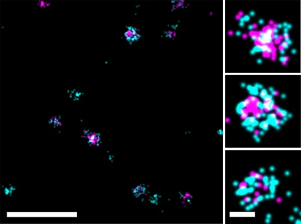 Super-resolution dSTORM images of human colorectal cancer cell line derived EVs. EVs were stained with anti-tetraspanin antibodies (an anti-CD9/CD63/CD81 cocktail, all conjugated to CF®647, shown in magenta) together with 1X ExoBrite™ 560/585 (in cyan). Samples were prepared using ONI's EV Profiler Kit and acquired using the Nanoimager S Mark II from ONI (Oxford Nanoimaging, UK). Data was processed using a beta-release version of CODI, ONI's cloud-based data analysis platform. Scale bars are 500 nm (zoomed out, left panel) and 50 nm for single-EV panels (right). Image courtesy of ONI.