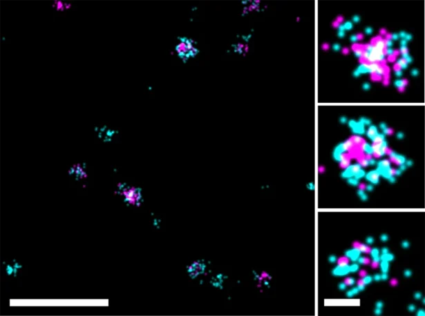 Super-resolution dSTORM images of human colorectal cancer cell line derived EVs. EVs were stained with anti-tetraspanin antibodies (an anti-CD9/CD63/CD81 cocktail, all conjugated to CF®647, shown in magenta) together with 1X ExoBrite™ 560/585 (in cyan). Samples were prepared using ONI's EV Profiler Kit and acquired using the Nanoimager S Mark II from ONI (Oxford Nanoimaging, UK). Data was processed using a beta-release version of CODI, ONI's cloud-based data analysis platform. Scale bars are 500 nm (zoomed out, left panel) and 50 nm for single-EV panels (right). Image courtesy of ONI.