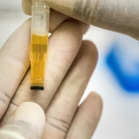 Human Urine-Derived Extracellular Vesicles