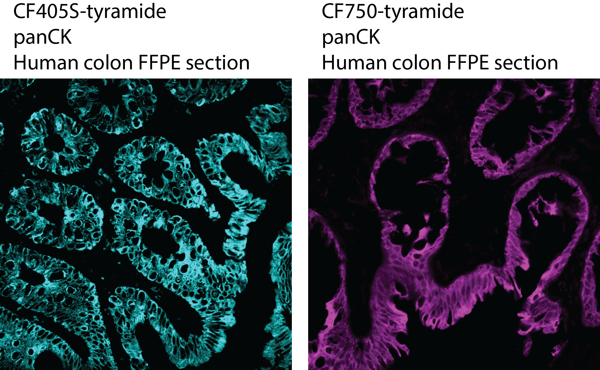 2uM of CF405S-tyramide (left) and 10uM of CF750-tyramide (right) staining human colon FFPE section labeled with mouse anti-panCK primary antibody and HRP-Goat anti-Mouse secondary antibody. The staining is performed using our Tyramide Enhancer Buffer.