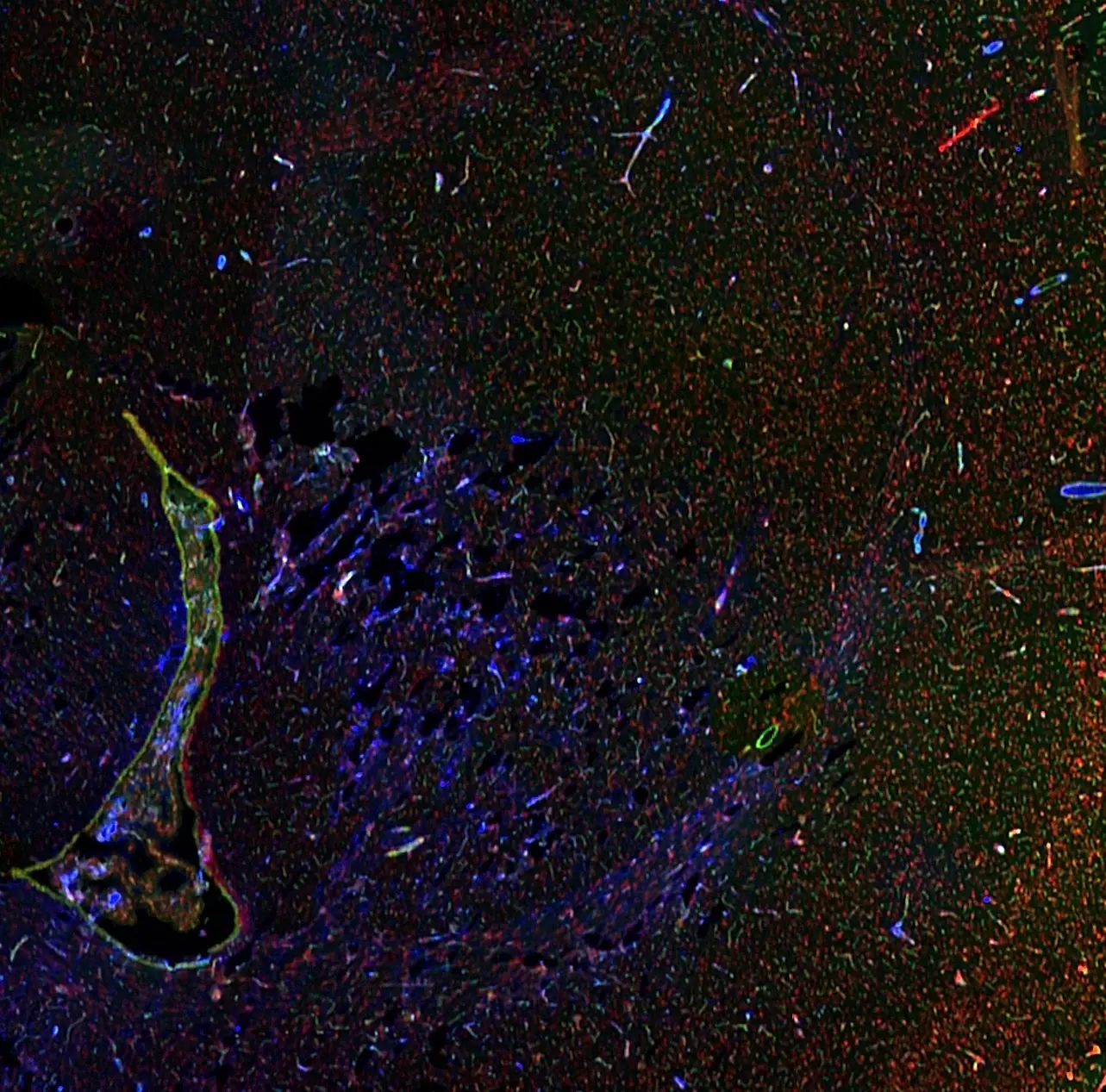 Section of rat brain and choroid plexus stained with mouse anti-GFAP GA5 antibody, HRP goat anti-mouse, and CF®740 Tyramide using Biotium's Tyramide Amplification Buffer Plus (glial cells, blue). Blood vessels were stained with CF®488A LEL Tomato Lectin (green), and nuclei were stained with NucSpot® 568/580 Nuclear Stain (red). Imaged on a LI-COR® Odyssey® M Imaging System in the 488, 520, and 800 channels.