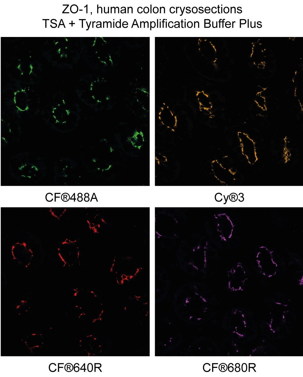 ZO-1 staining in human colon cryosections detected using CF®488A, Cyanine 555 (Cy®3), CF®640R, and CF®680R tyramide with Biotium's Tyramide Amplification Buffer Plus.