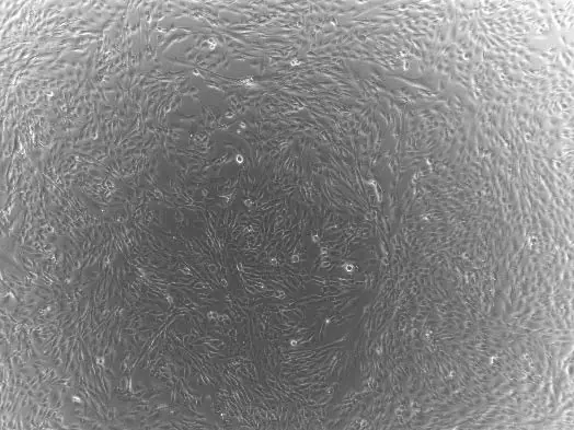 4× microscopy image of human adipose-derived MSC (AD-MSC) culture showing homogeneous fibroblast-like morphology, high confluency, and absence of differentiation or contamination.